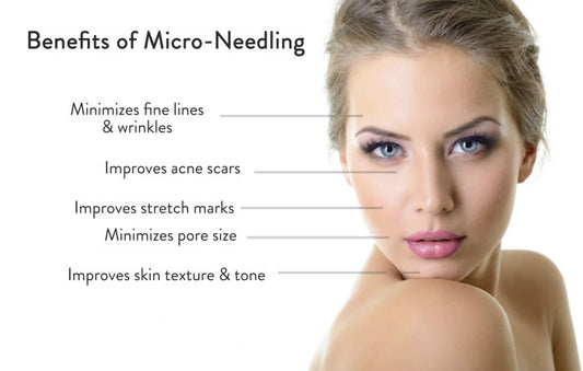 Microneedling package of 4 sessions- $410